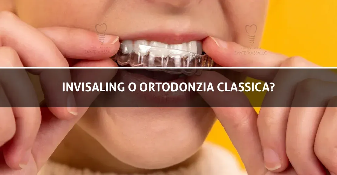 Invisalign o ortodonzia classica?