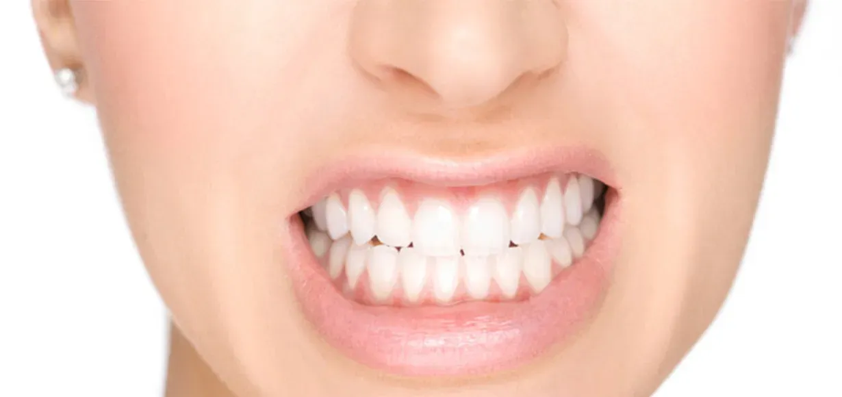Il bruxismo