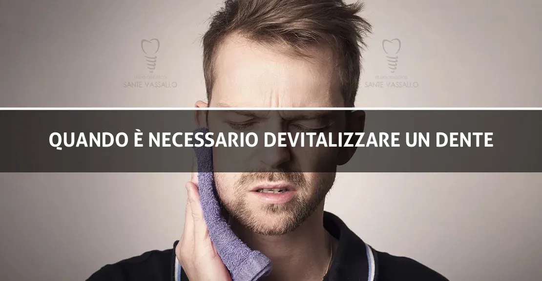 Quando è necesasrio devitalizzare un dente - Sante Vassallo