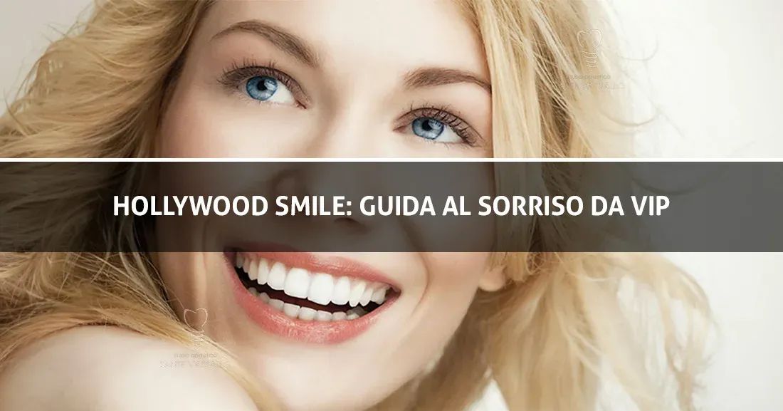 Hollywood Smile - Studio Dentistico Sante Vassallo