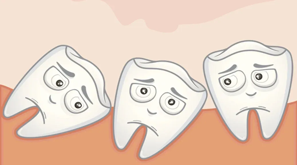 Denti storti-cause, conseguenze e terapie