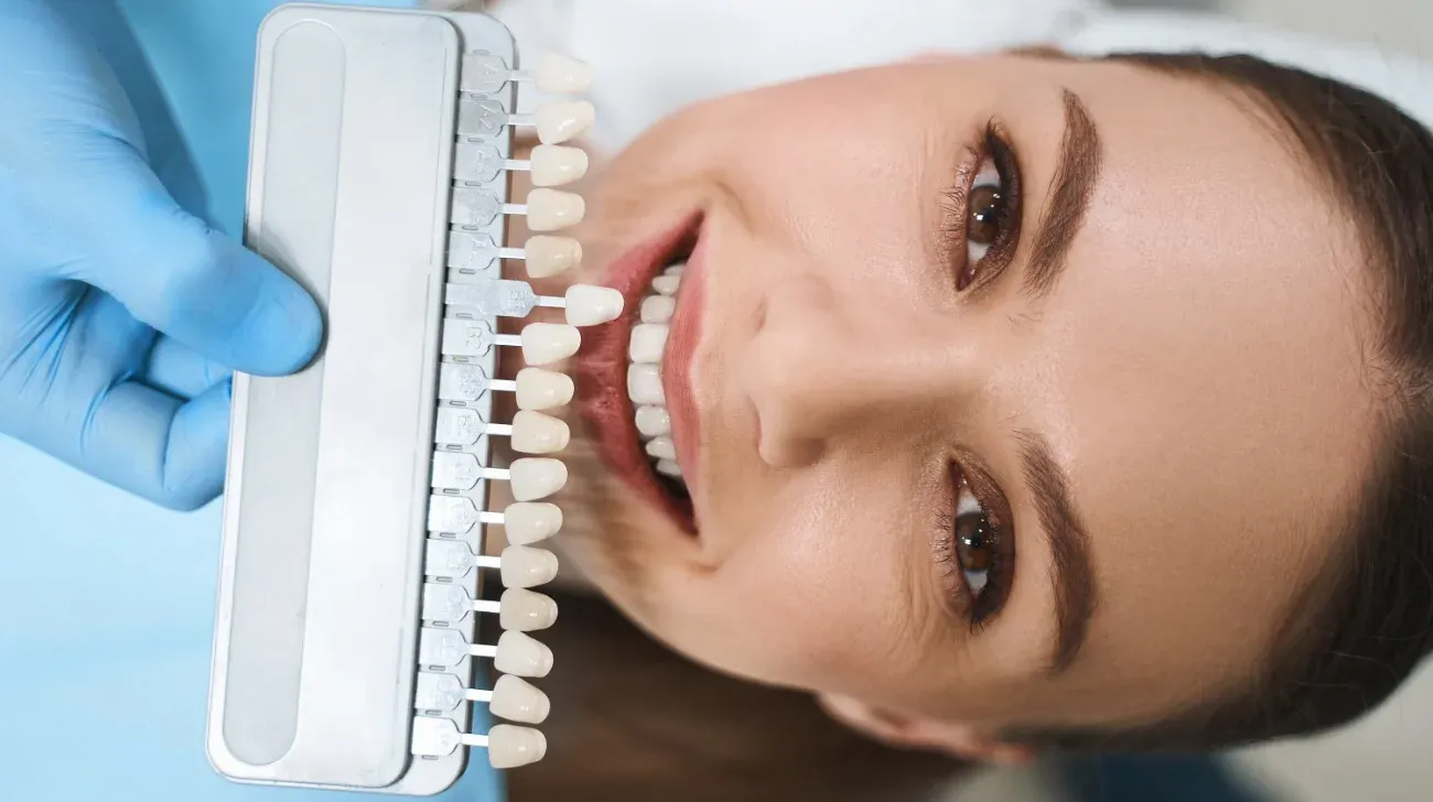 Specialisti in estetica del sorriso