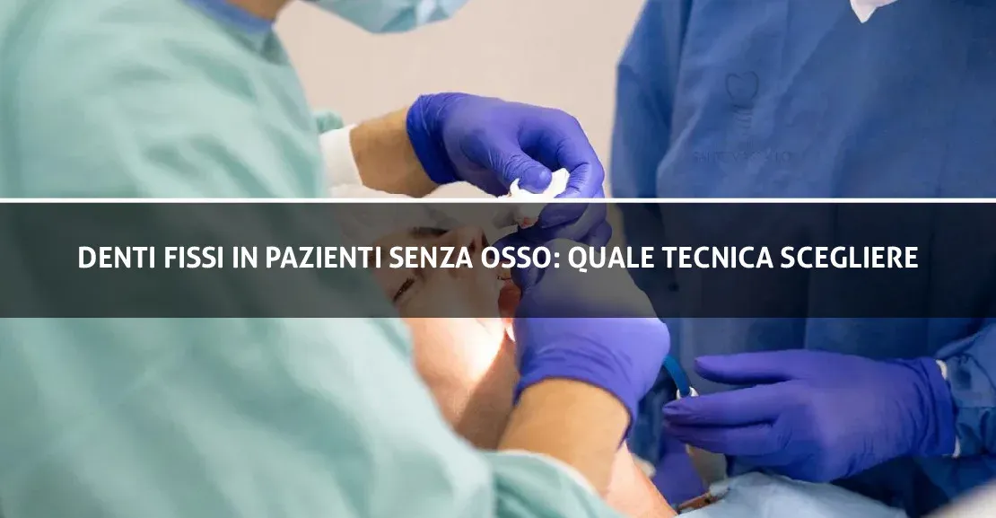 Denti fissi in pazienti senza osso: Quale tecnica scegliere?