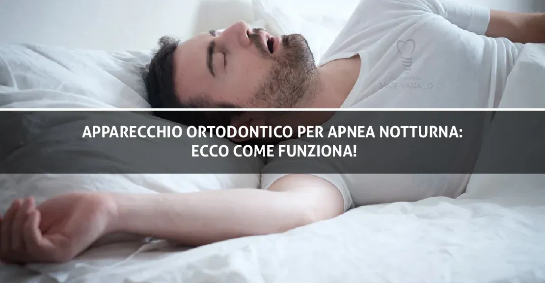 Apparecchio ortodontico per apnea notturna: ecco come funziona!